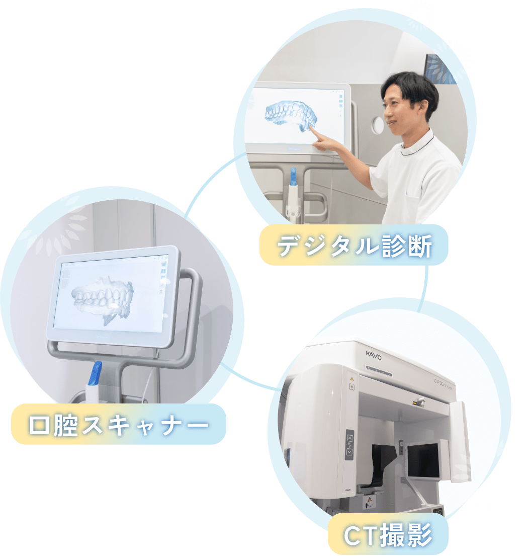 デジタル診断　口腔スキャナー　CT撮影