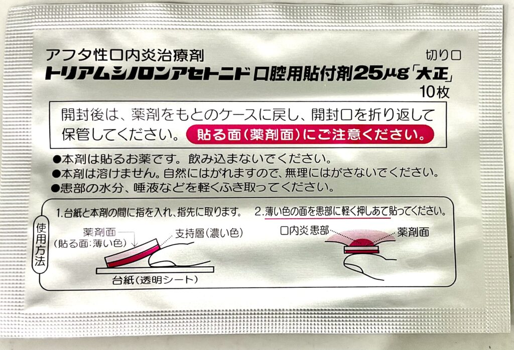 矯正装置が当たってできた口内炎の治療に使える口腔用貼付薬|アフタ性口内炎治療薬