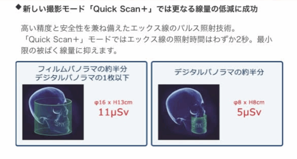 小学生の犬歯位置確認に使用する歯科CTの被ばく量比較図。日常生活の自然放射線と比較し、安全性を説明