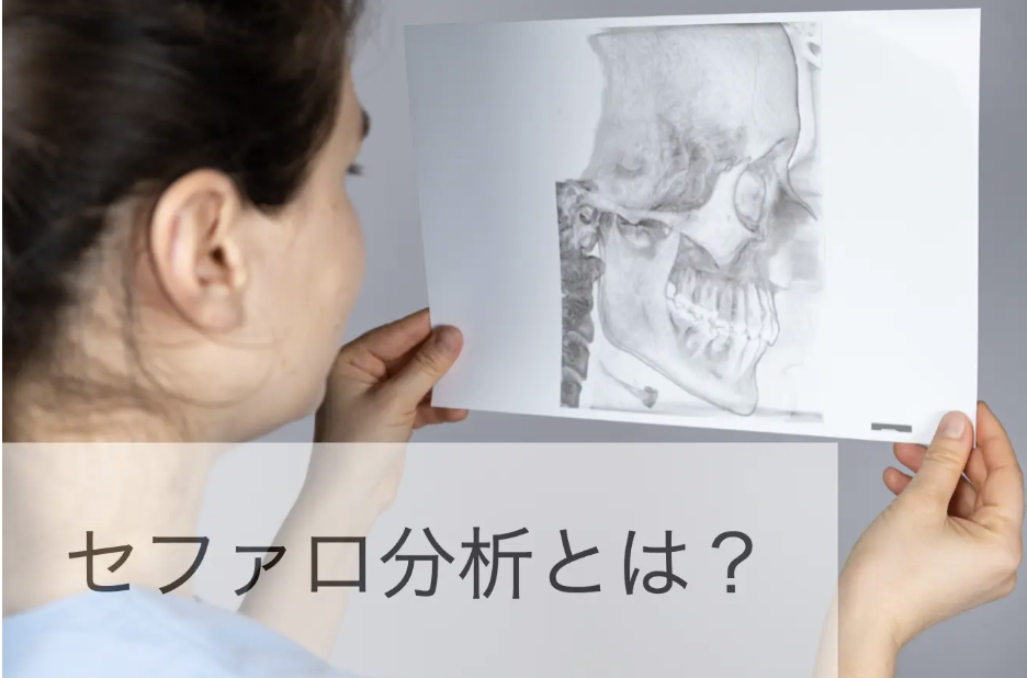 セファロ分析とは?矯正歯科で開咬や骨格性不正咬合を診断するレントゲン分析
