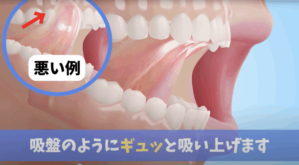 MFT 舌の運動 ミューイング