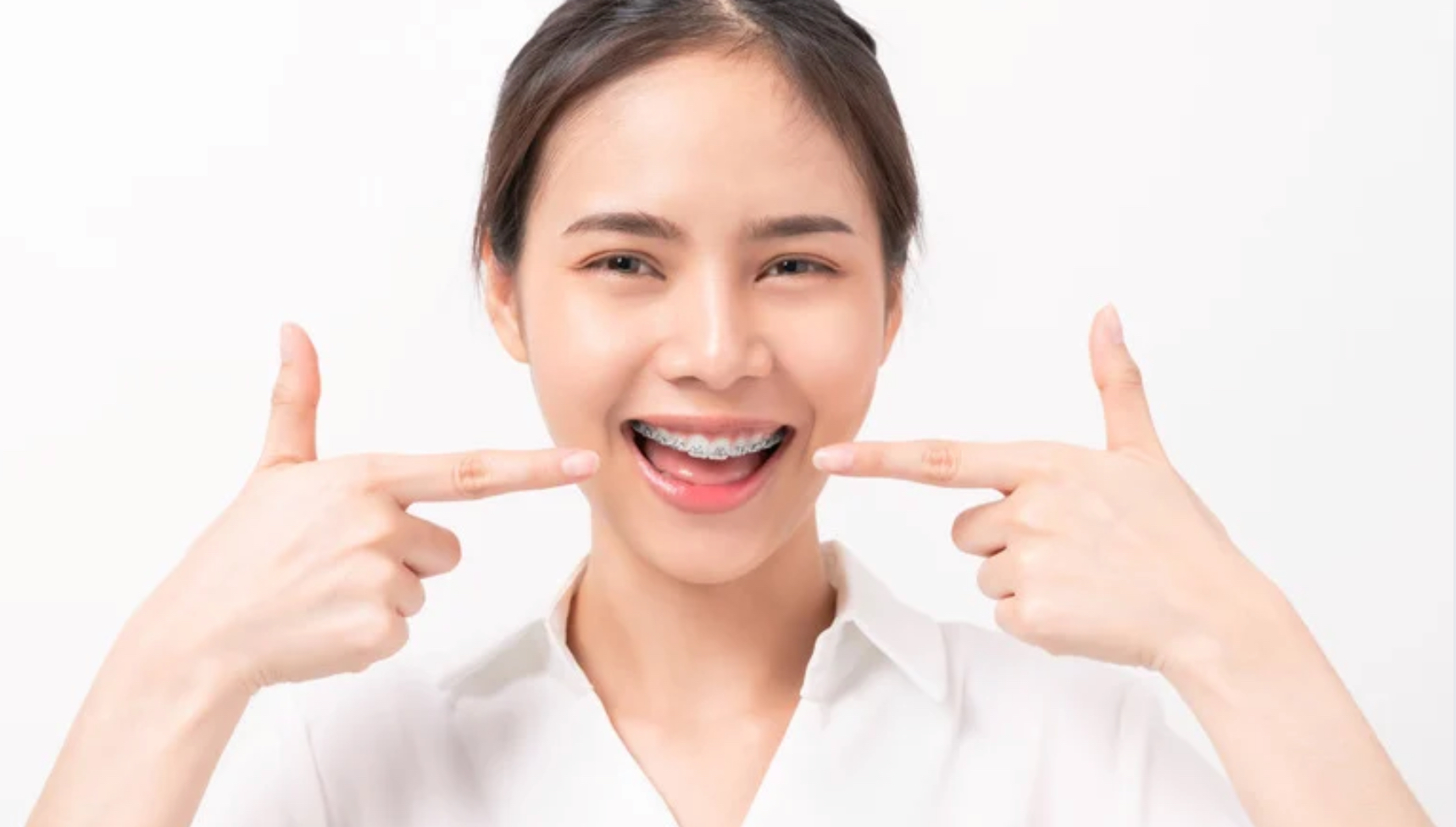 奈良で八重歯矯正するなら表側矯正・裏側矯正