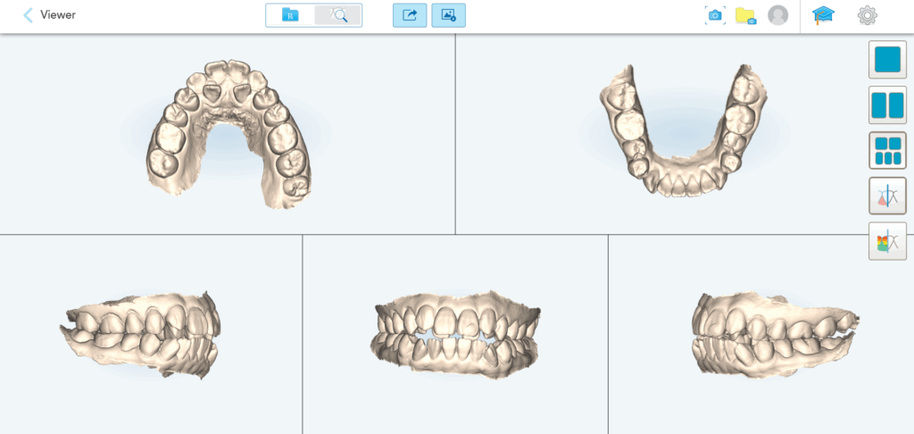 3D画像 アイテロ画像