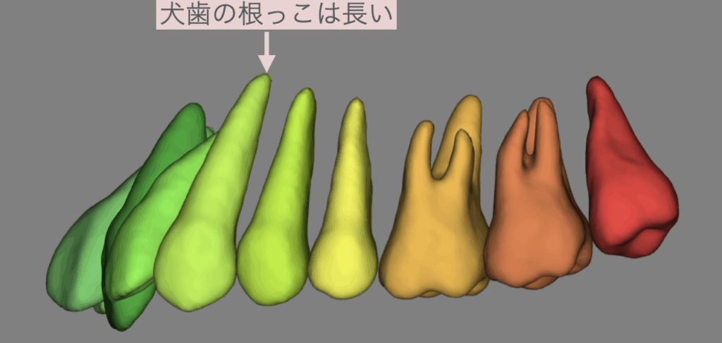 出っ歯の矯正治療　上の犬歯が前方位