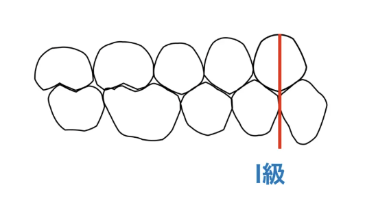 犬歯　いい位置