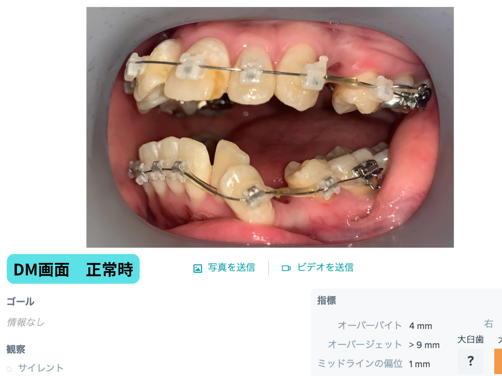 #26-写真7 DM正常時