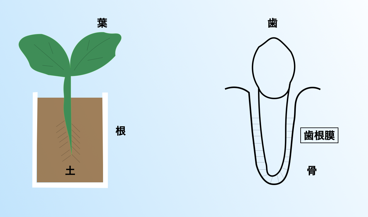 植木鉢と歯の構造の比較図（土＝歯根膜）