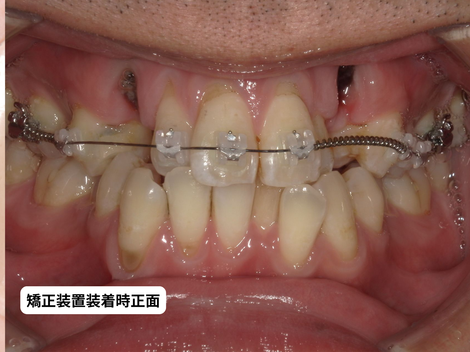 #26-写真3 装置装着 正面