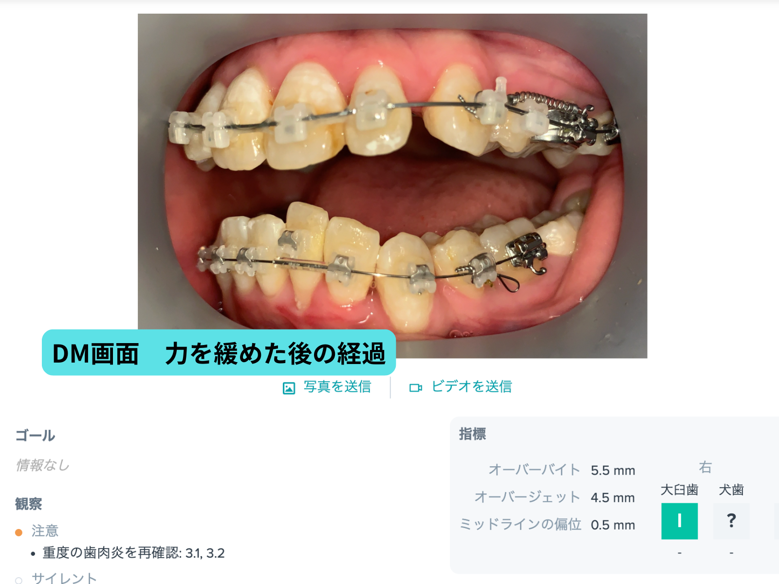 #26-写真9 DM対応後