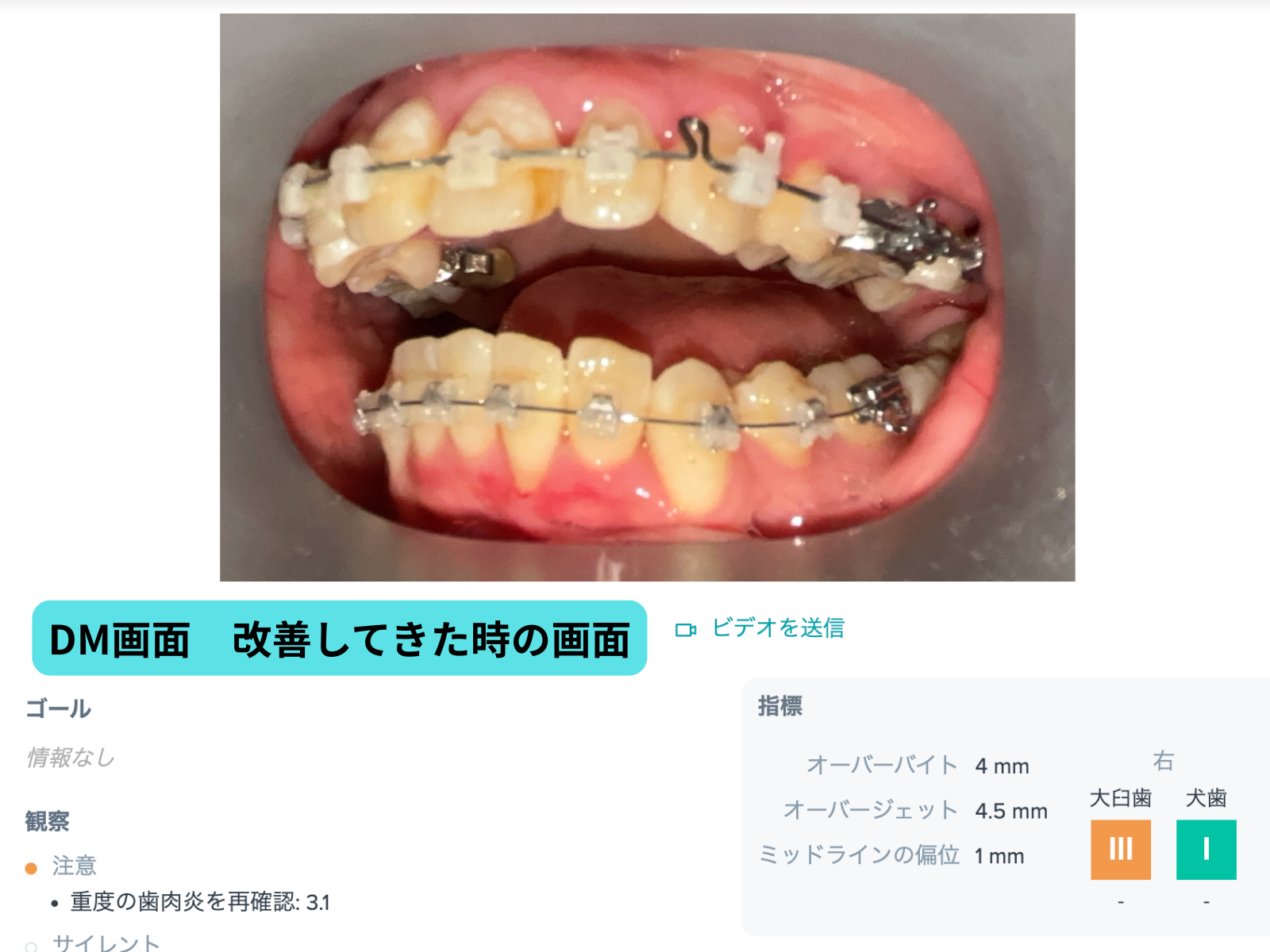 #26-写真10 DM改善中