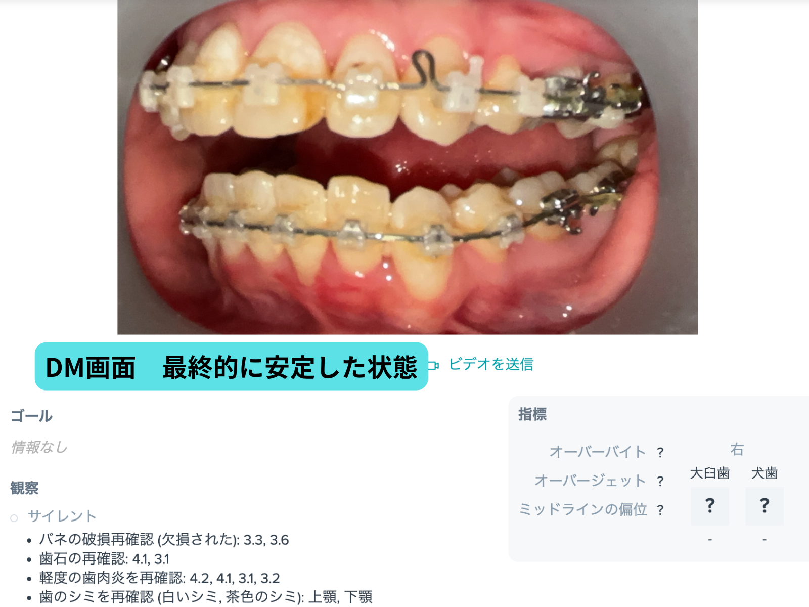 #26-写真11 DM安定