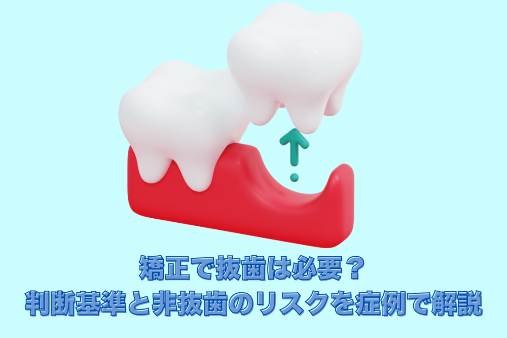 矯正で抜歯は必要？判断基準と非抜歯のリスクを症例で解説