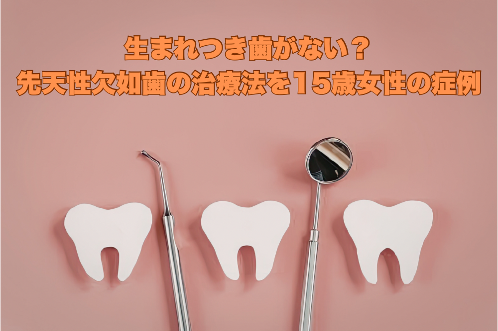生まれつき歯がない？先天性欠如歯の治療法を15歳女性の症例