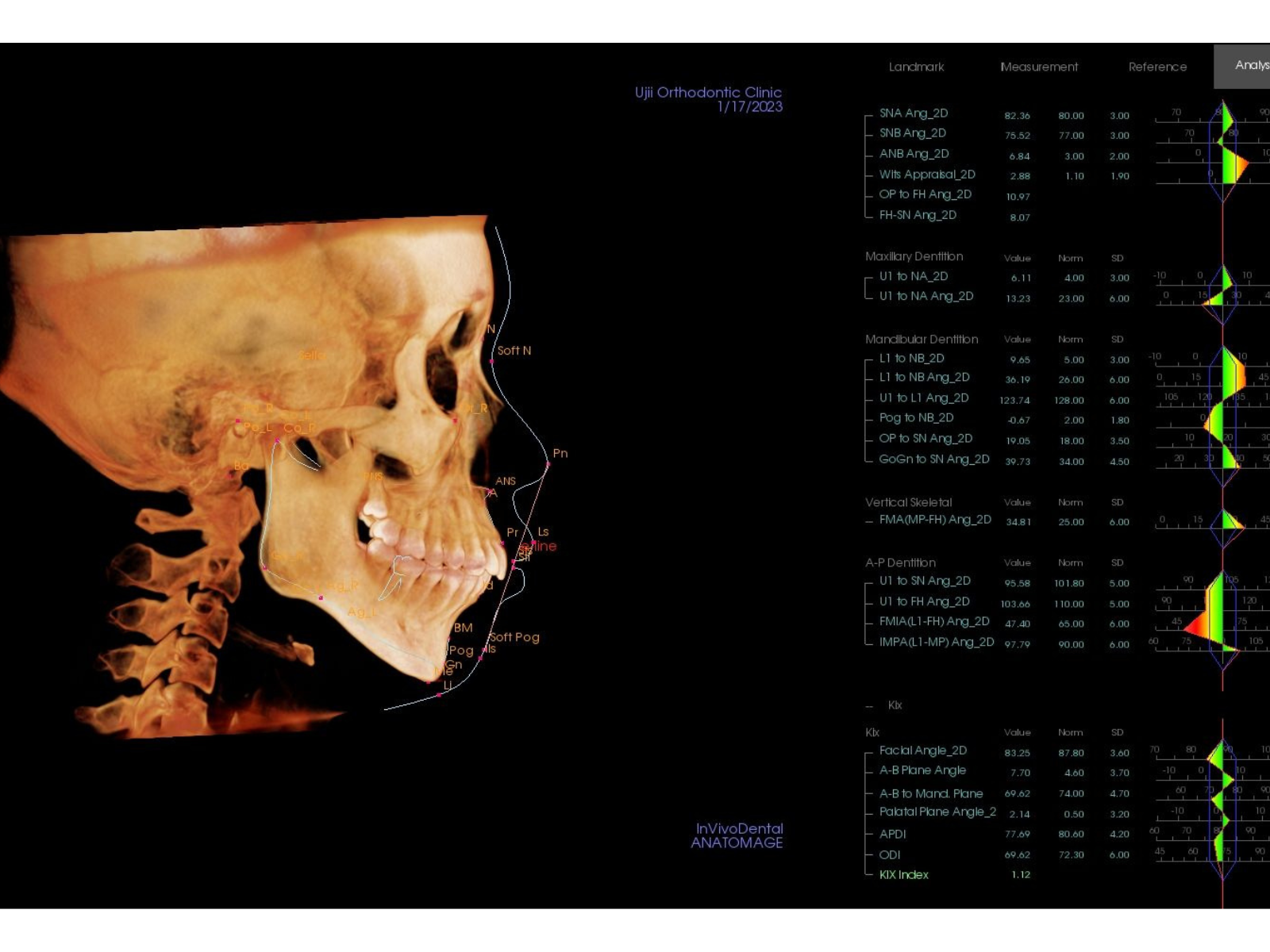 初診時セファロ分析（79-04）｜奈良の矯正歯科