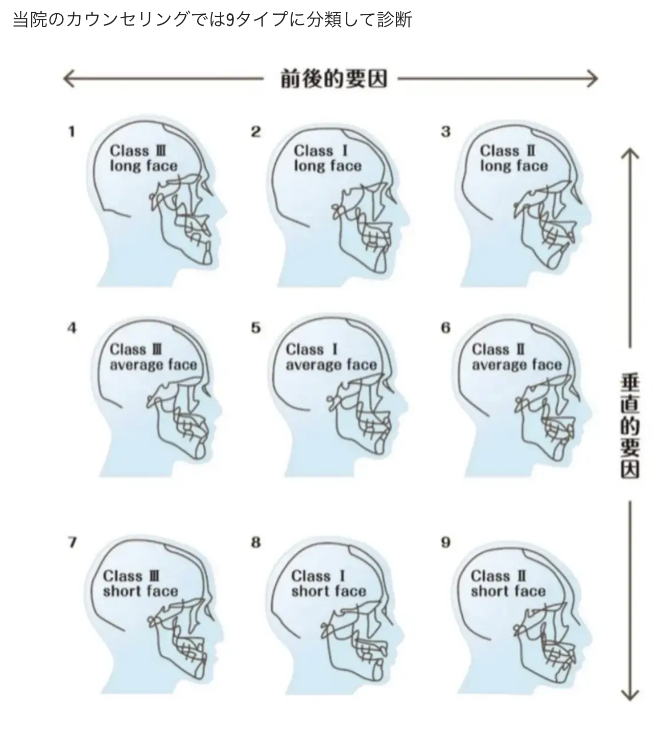 上下あごの前後関係と顔の縦の長さの組み合わせによる噛み合わせの9分類。横方向が上あご・下あごの前後関係、縦方向が顔の長さを表す