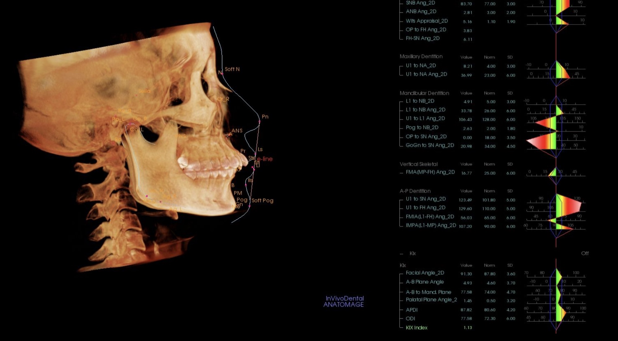 治療前のセファロ分析：頭部の3D画像と各計測値